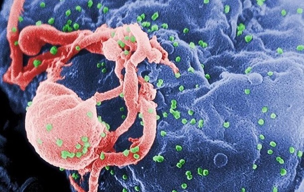 Найден способ уничтожения ВИЧ в организме