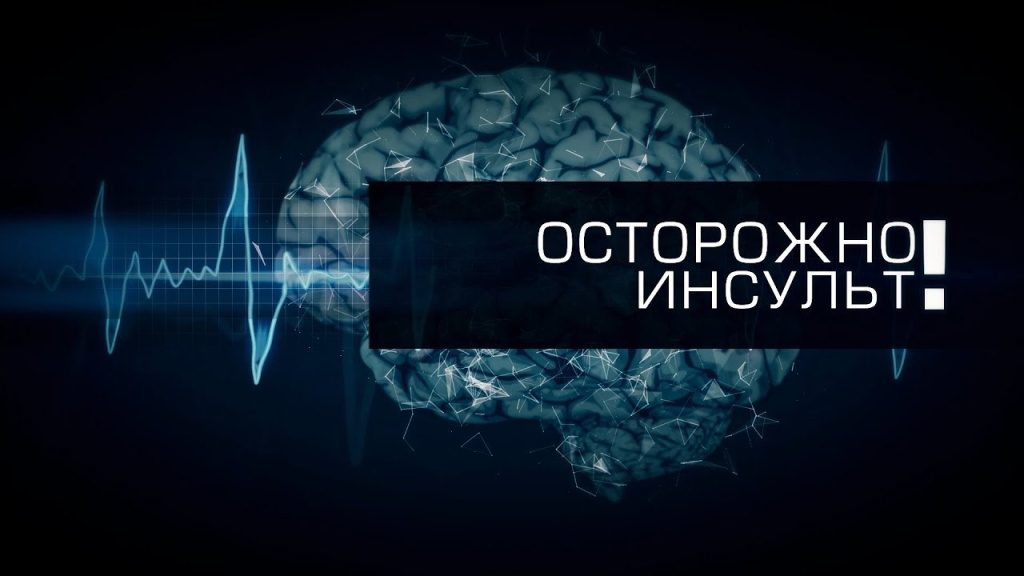 Вероятность развития инсульта после 50 Вероятность развития инсульта после 50