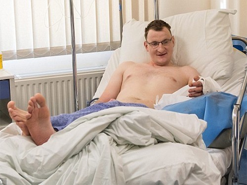 В Польше впервые пересадили руку взрослому мужчине, родившемуся без нее