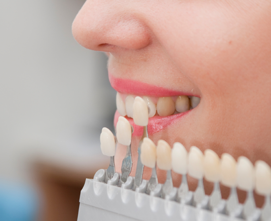 лечение и протезирование зубов