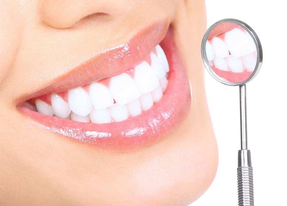 Отбеливание зубов в домашних условиях, профессионально, стоматологи